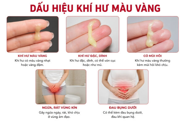 Khí hư có màu vàng: dấu hiệu cảnh báo ngầm các bệnh phụ khoa nguy hiểm