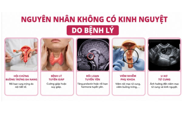 Không có kinh do đâu? có nguy hiểm không?