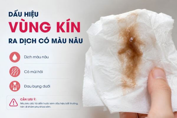 Dịch có màu nâu là bị gì? nguy hiểm không?