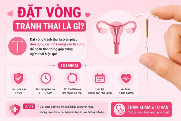 Đặt Vòng Tránh Thai: Quy Trình, Chi Phí Và Những Điều Chị Em Cần Biết
