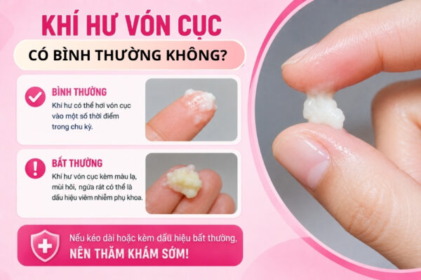 Khí Hư Vón Cục Là Bình Thường Hay Dấu Hiệu Bệnh Phụ Khoa?