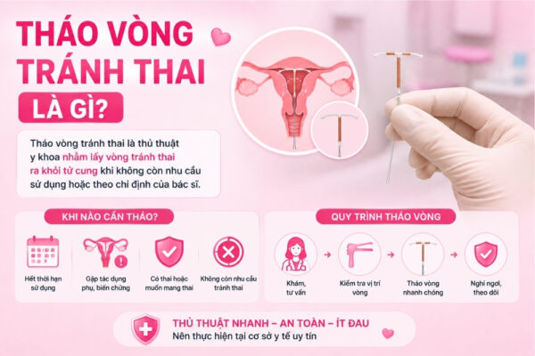 Tháo Vòng Tránh Thai Có Đau Không? Quy Trình, Chi Phí Và Lưu Ý
