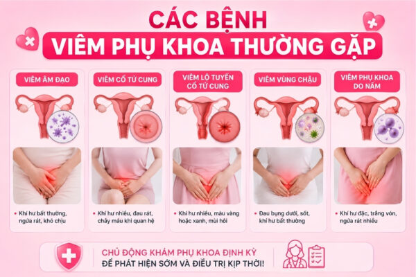 Điều Trị Viêm Phụ Khoa Như Thế Nào? Khi Nào Cần Đi Khám?